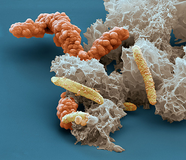 Scanning electron microscope image of iron oxidizing bacteria Acidovorax sp. BoFeN1, encrusted in iron minerals. Microbes, enzymes and minerals are often intimately associated in soils, making it difficult to separate out their contributions to biochemical reactions. Source: Eye of Science, Reutlingen