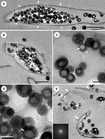 TEM images showing silica nanoparticles inside and outside cells. Note the light colored "virus-like cores" clearly visible in panels c and d, surrounded by a silicious shell. Credit: Peng et al. 2013